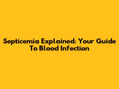 Septicemia Explained: Your Guide To Blood Infection